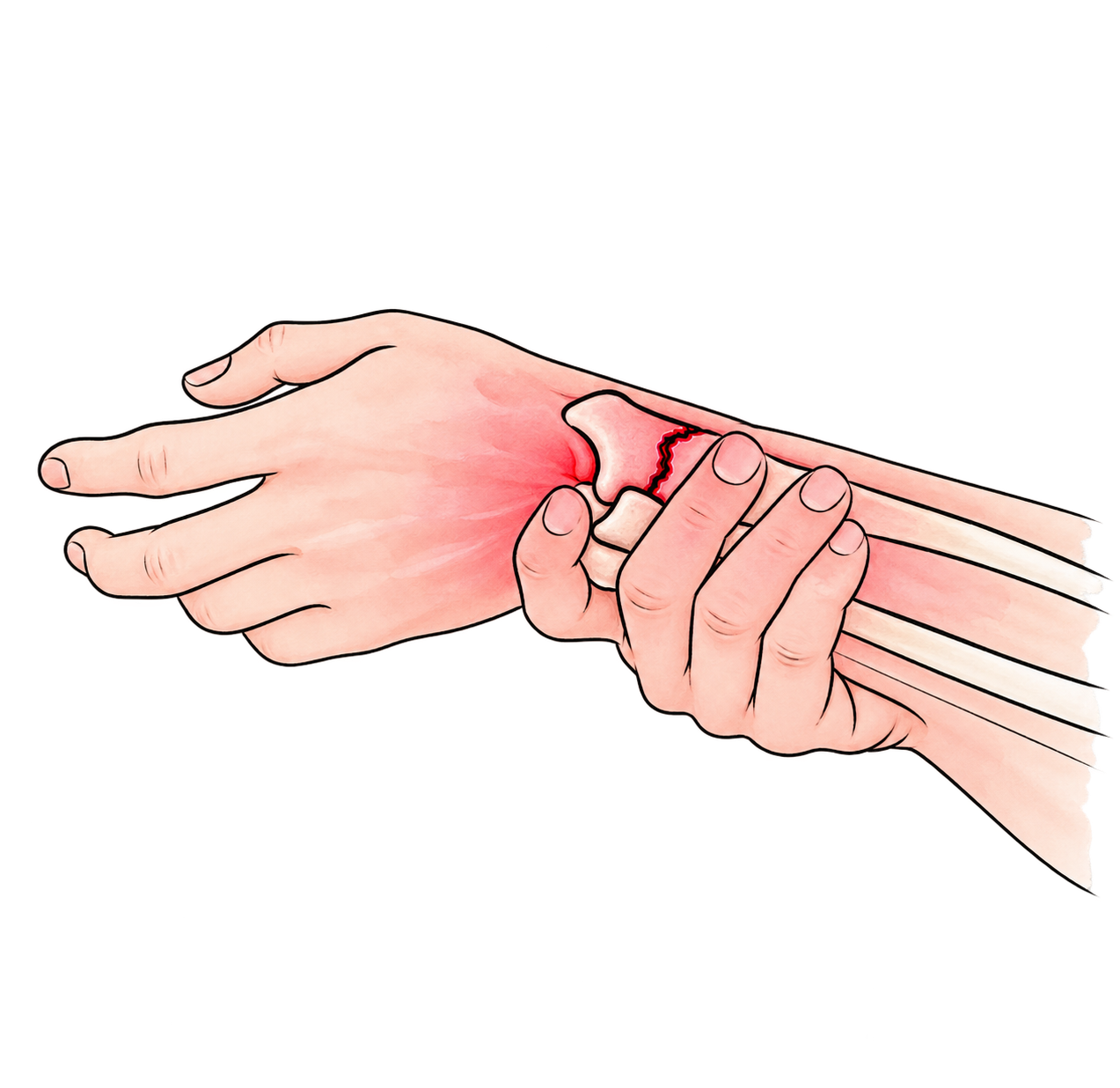 Orthopaedic Trauma